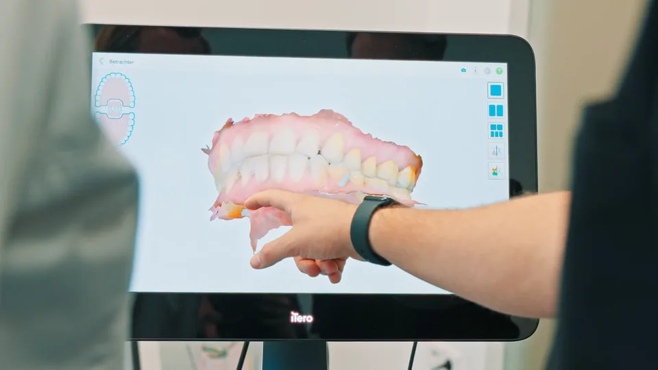 Digitaler Zahnscan auf dem Bildschirm im Behandlungszimmer